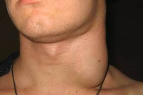 �������������� : �������, ��������, ����������� � ������� � ������ | ����