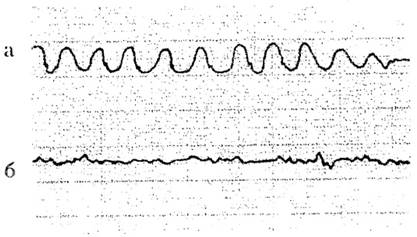 ����������� 005